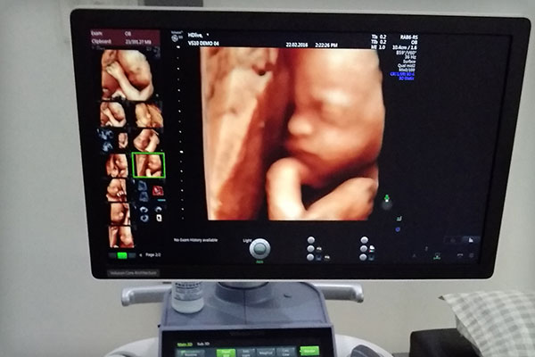 Pregnancy Scans and 3D-4D Imaging